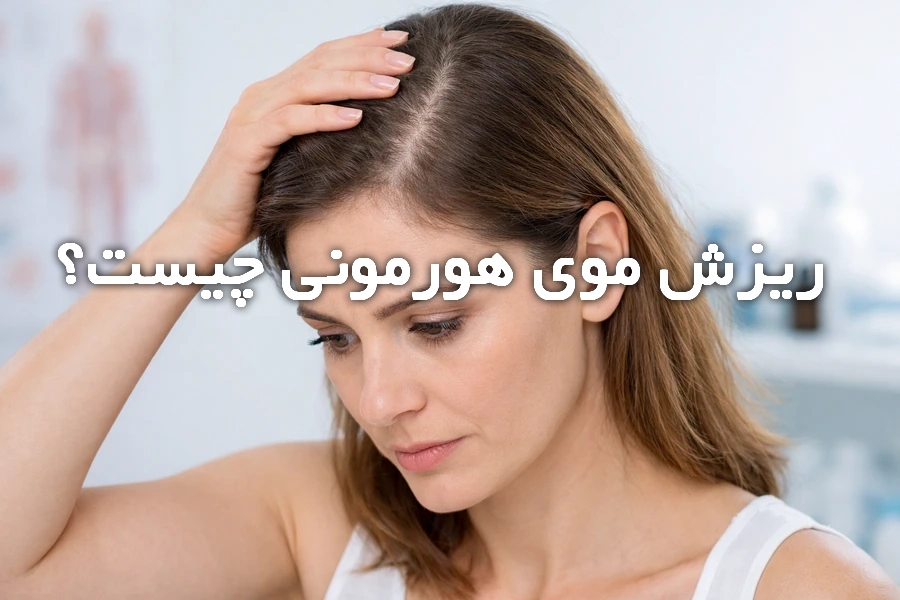 ریزش مو هورمونی در زنان و تأثیر هورمونها بر کمپشتی مو